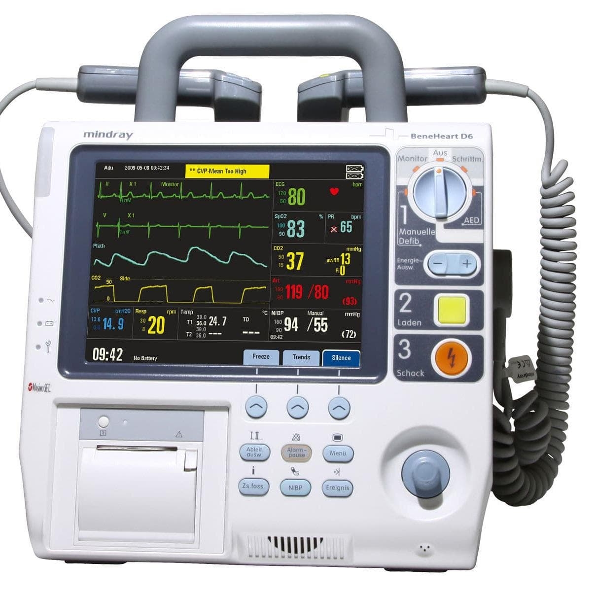 Defibrillator